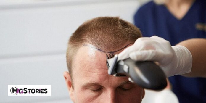 Hair Transplant Surgery