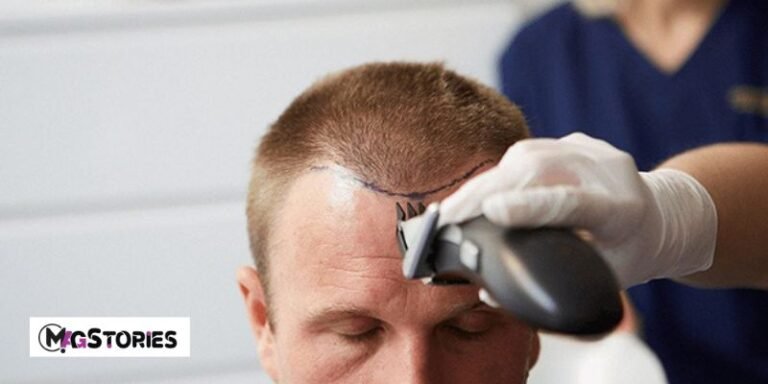 Hair Transplant Surgery