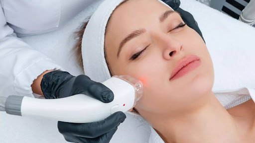 RF Microneedling Boynton Beach